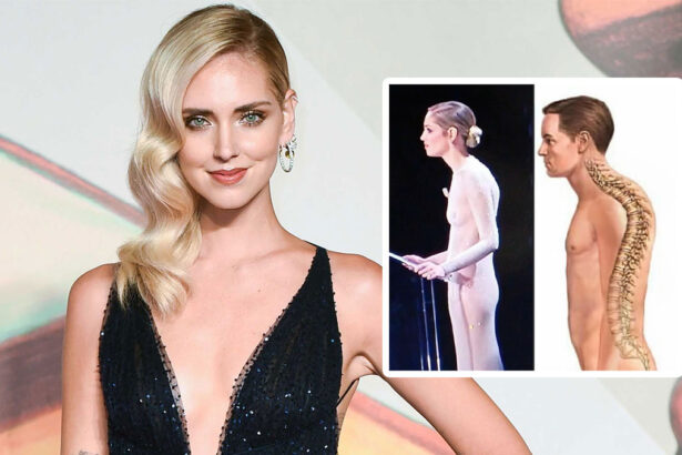 La schiena della Ferragni utilizzata come esempio di ipercifosi sul sito Medicina Online 7