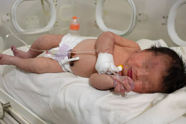 Siria, miracolo sotto le macerie: trovata neonata legata al cordone ombelicale 9