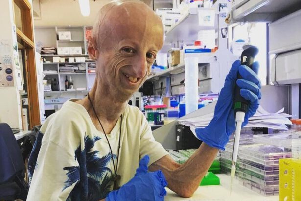 Sammy Basso: ci sarà la beatificazione tra 5 anni? Parla il vescovo di Vicenza 14