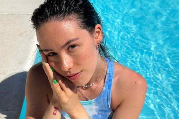 Allergia al Sole, anche Aurora Ramazzotti ne soffre: come proteggersi durante le vacanze 10