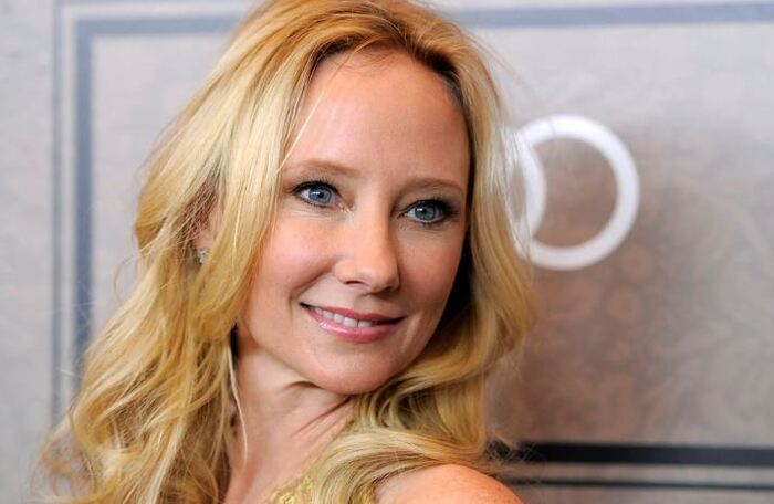 Anne Heche, l'annuncio della famiglia: ”Staccheremo la spina, è cerebralmente morta” 3