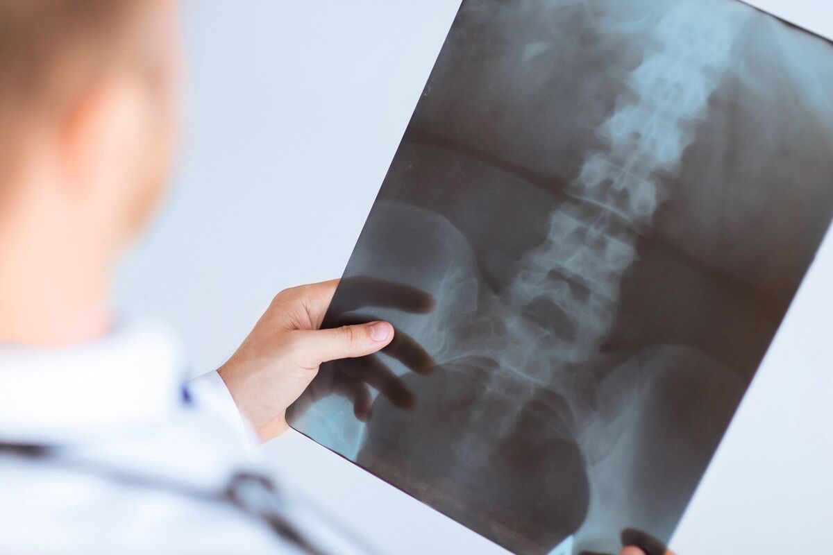 Non cammina senza busto, pazienti, medici e infermieri glielo regalano: "Sono come una famiglia" 15