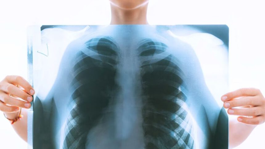 Tumore al polmone, diagnosi precoce grazie a una piattaforma robotica 1