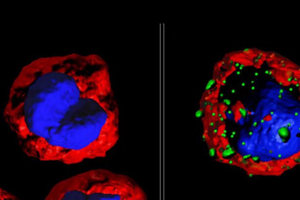 Possibile svolta nella cura del cancro: AI trova le cellule in grado di uccidere i tumori 17