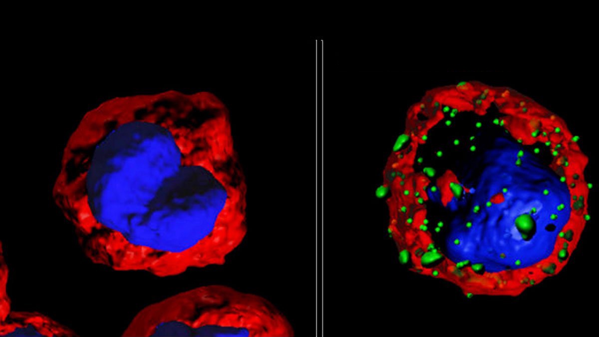 Possibile svolta nella cura del cancro: AI trova le cellule in grado di uccidere i tumori 13
