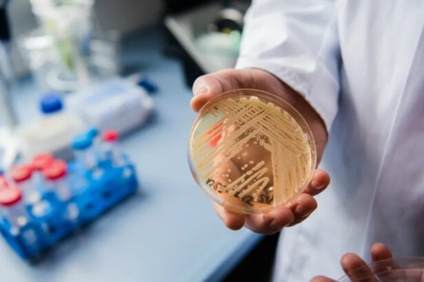 Candida auris, caso di fungo killer isolato in Toscana: come si prende e perché preoccupa 13