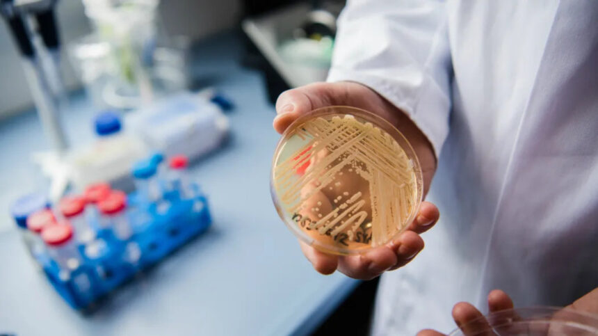 Candida auris, caso di fungo killer isolato in Toscana: come si prende e perché preoccupa 2 Candida auris, caso di fungo killer isolato in Toscana: come si prende e perché preoccupa 1