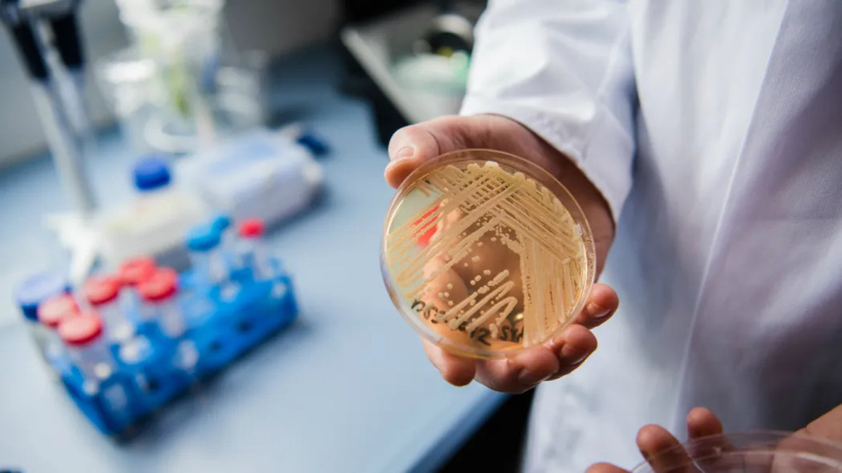 Candida auris, caso di fungo killer isolato in Toscana: come si prende e perché preoccupa 11