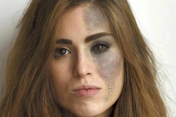 Chi è Carlotta Bertotti, la bellissima modella con un nevo di Ota sul volto 7