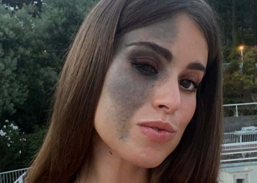 Carlotta Bertotti e il nevo di Ota sul viso: “Quella vita non mi rendeva felice. Non lo copro più” 1