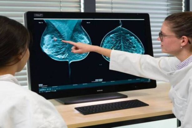 Tumore al seno, farmaco riduce rischi di recidive e metastasi: "Aumenta la qualità della vita" 6