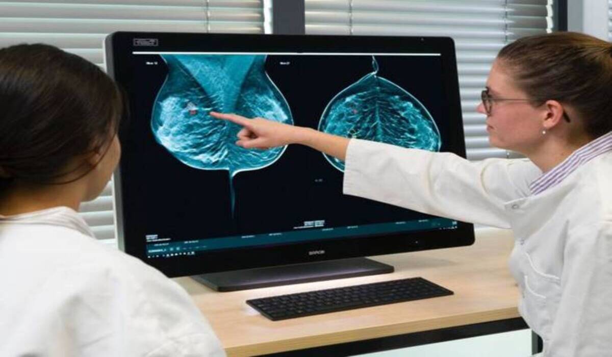 Tumore al seno, farmaco riduce rischi di recidive e metastasi: "Aumenta la qualità della vita" 13