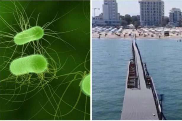 Escherichia Coli, stop alla balneazione in Riviera: cos'è, sintomi e rischi 14