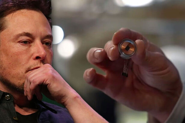 Elon Musk ha impiantato un chip per la prima volta nel cervello umano: come funziona? 7