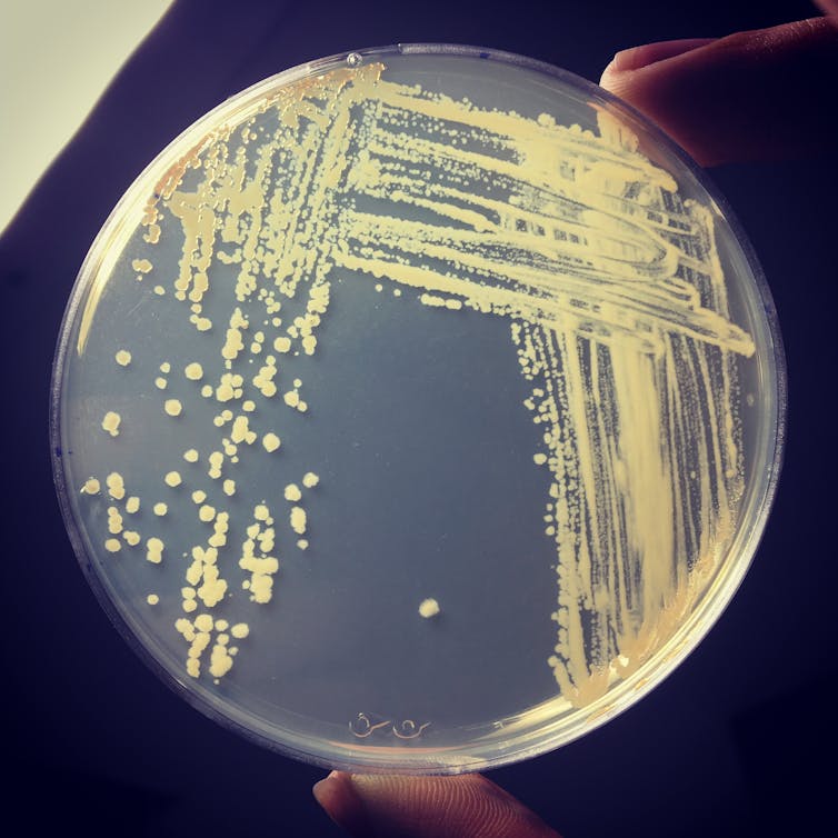 Energia dall'aria, i batteri come batterie naturali 4 Energia dall'aria, i batteri come batterie naturali 3