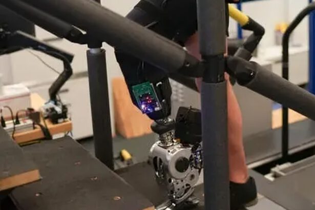 La gamba bionica controllata dal cervello: 7 pazienti amputati cammio come prima 10