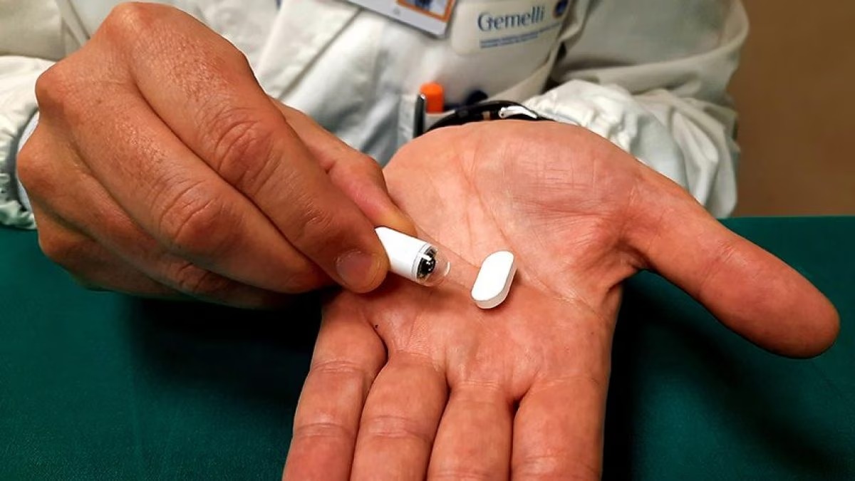 Prima gastroscopia al mondo senza tubo: come funziona la video-pillola da inghiottire del Gemelli 13