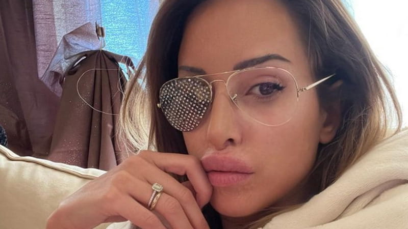 Gessica Notaro riacquisterà la vista all'occhio sinistro con un intervento: "È un miracolo" 3