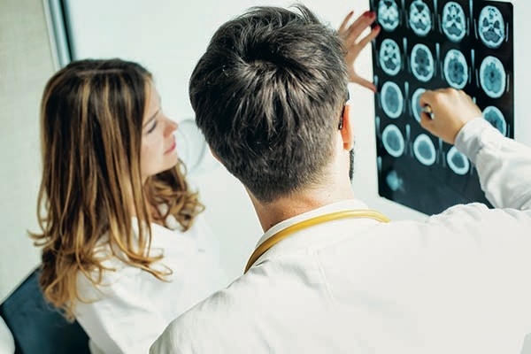 Uomo colpito da ictus e incapace di parlare, ora comunica in 2 lingue grazie a impianto cerebrale AI 3