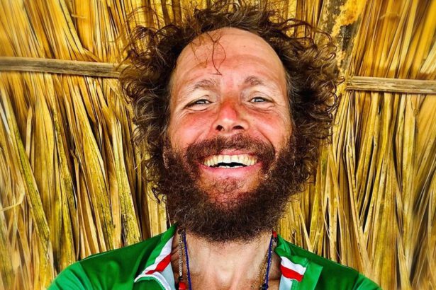 Jovanotti rassicura i fan dopo l'incidente: "Il vostro affetto è un antidolorifico magnifico" 14