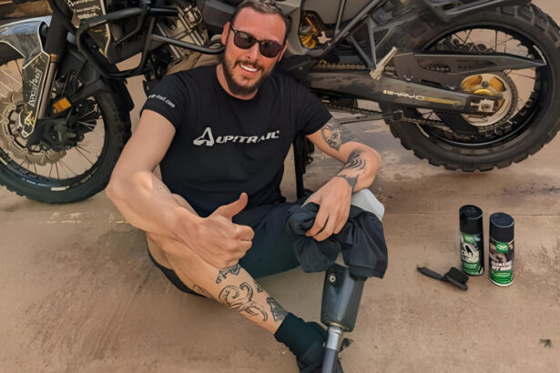 Chi era Luca Falcon, muore a 35 anni, dopo aver perso una gamba raccoglieva protesi per bimbi africani 11