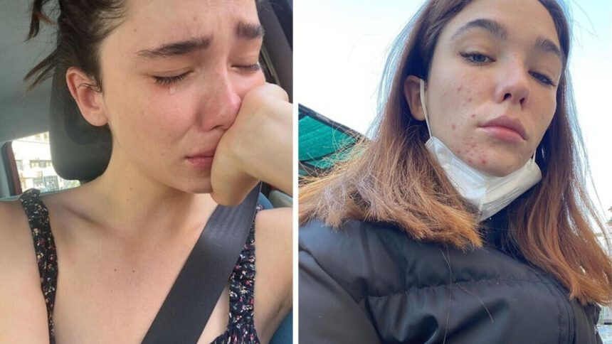 Matilda De Angelis: “Ho l'ansia. Gli standard di perfezione mi hanno intossicato la mente” 1