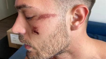 Matteo Falcinelli, lo studente arrestato a Miami non sarà processato: la decisione del giudice 3