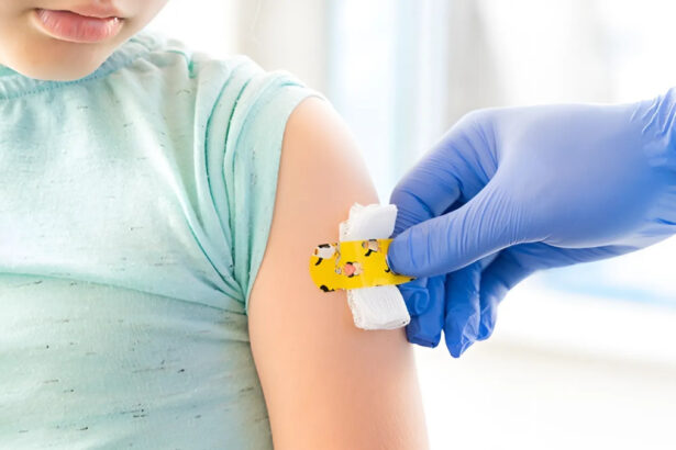 Morbillo, quali sono gli ultimi dati, cosa dice Bassetti e come evitare un'epidemia? 38