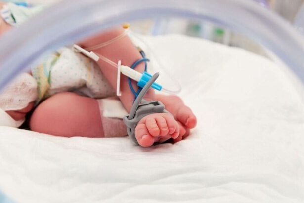 Intervento record al Bambino Gesù: rimosso tumore di 2 kg dal fegato di una bimba di 10 mesi 6