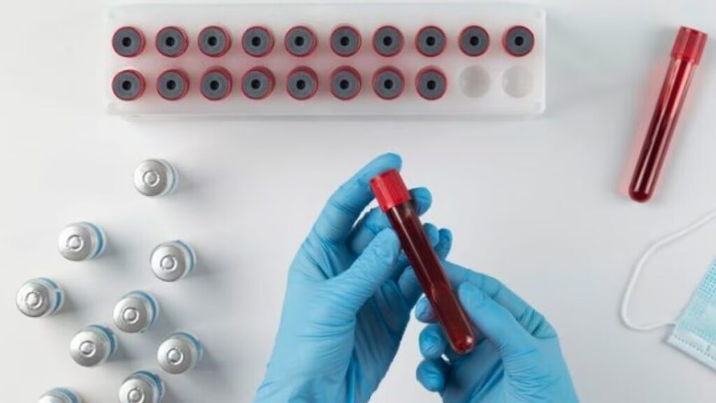 Cosa sappiamo sulla piastrinopenia di cui soffre Papa Francesco 4 Cosa sappiamo sulla piastrinopenia di cui soffre Papa Francesco 3