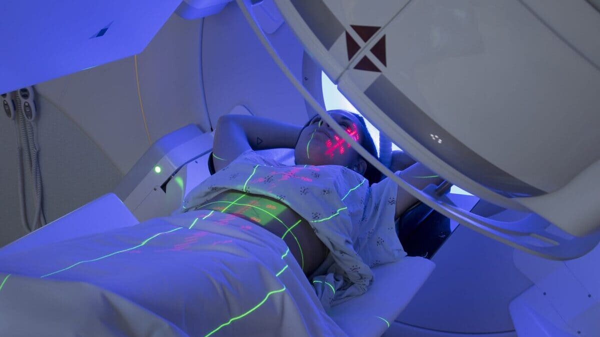 Radioterapia con elettroni contro i tumori: cos'è e come funziona la tecnologia Flash 13