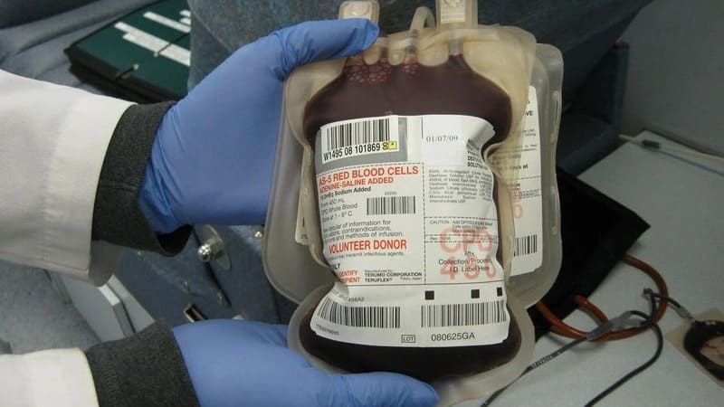 Regno Unito, prima trasfusione al mondo di sangue artificiale su esseri umani 3 sangue artificiale