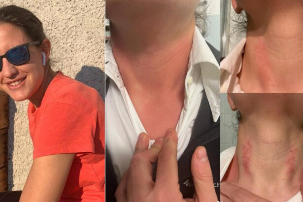 Udine, specializzanda aggredita in ospedale durante il turno di notte: "Cambierò lavoro" 14