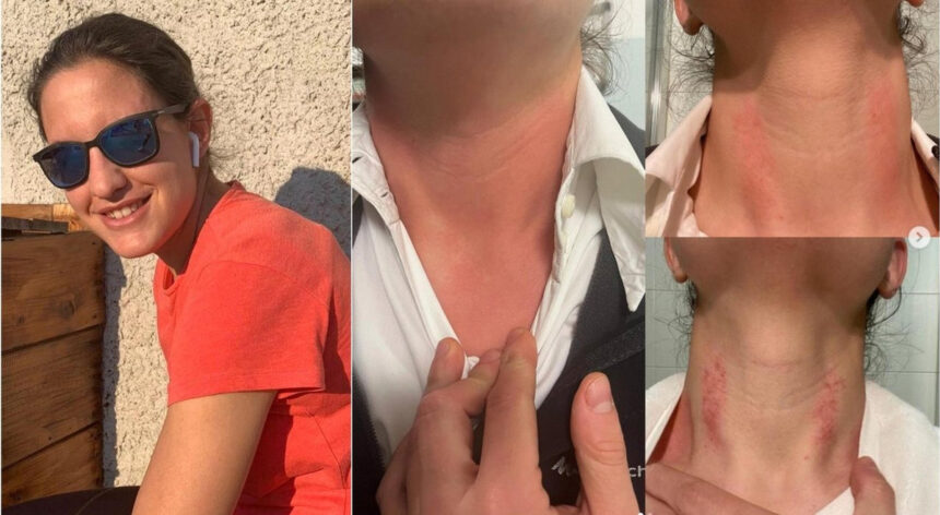 Udine, specializzanda aggredita in ospedale durante il turno di notte: "Cambierò lavoro" 2 Udine, specializzanda aggredita in ospedale durante il turno di notte: "Cambierò lavoro" 1