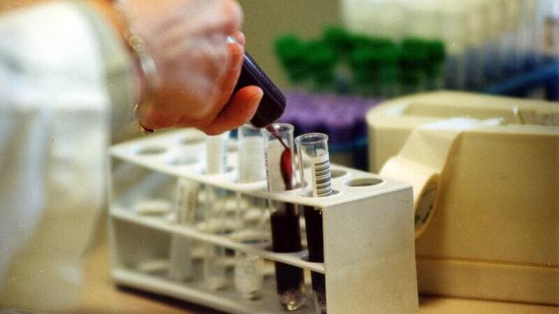 Test sul sangue che scoprono i tumori: quanto sono attendibili? 3 test sul sangue che scoprono tumori_