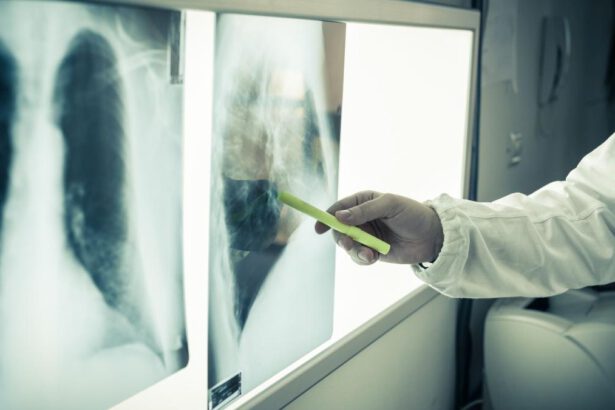 Giornata mondiale contro il cancro, screening gratuiti per la prevenzione 21