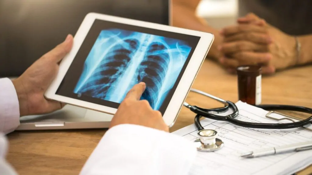 Tumore al polmone, diagnosi precoce grazie a una piattaforma robotica 3