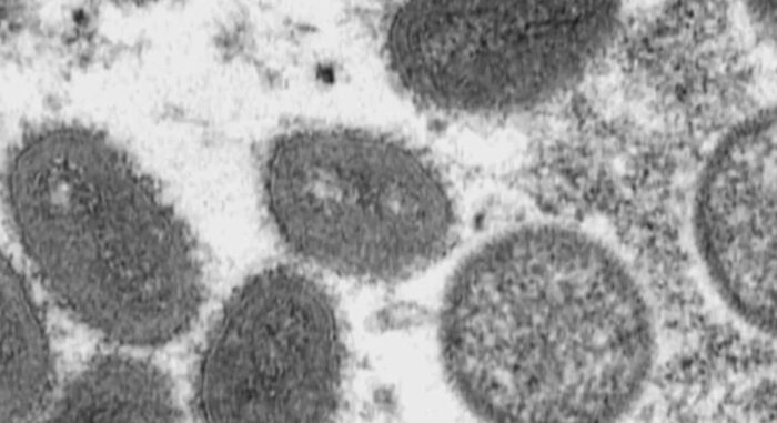 Vaiolo delle scimmie: la prima vittima italiana è un carabiniere morto a Cuba 3