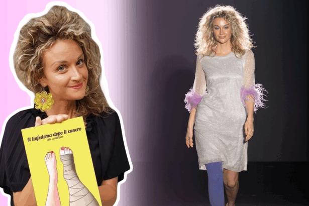 Chi è Anna Maisetti, la prima modella con linfedema: "Dal cancro alla Milano Fashion Week" 5