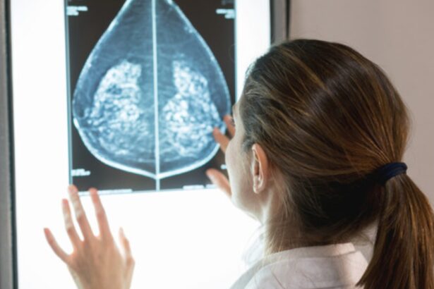 Arriva Elacestrant, il farmaco che blocca il tumore al seno metastatico 29