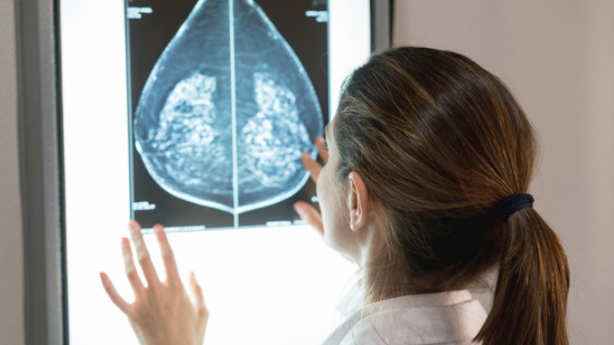 Arriva Elacestrant, il farmaco che blocca il tumore al seno metastatico 13