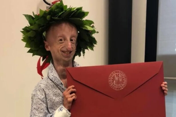 Nasce la prima scuola in nome di Sammy Basso: "Insegniamo ad affrontare la vita con il sorriso" 17