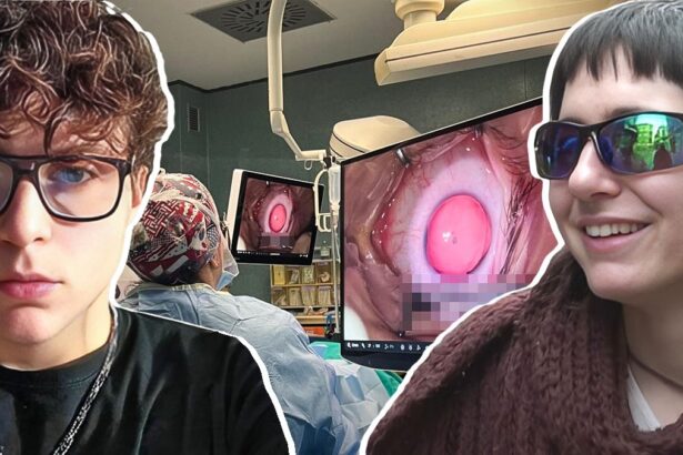 A Torino un intervento dona l'iride a due fratelli affetti da malattia congenita 7