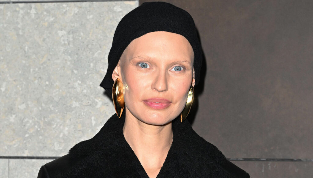 Cos'è la terapia con gli inibitori PARP a cui si sottoporrà Bianca Balti 3