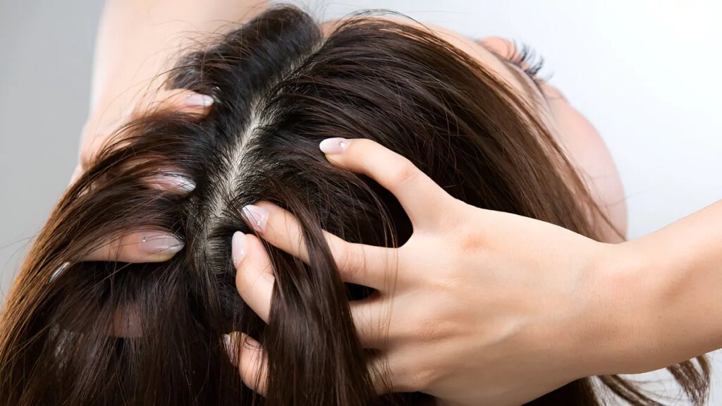 Ritlecitinib, il farmaco contro l’alopecia areata che fa ricrescere i capelli 3