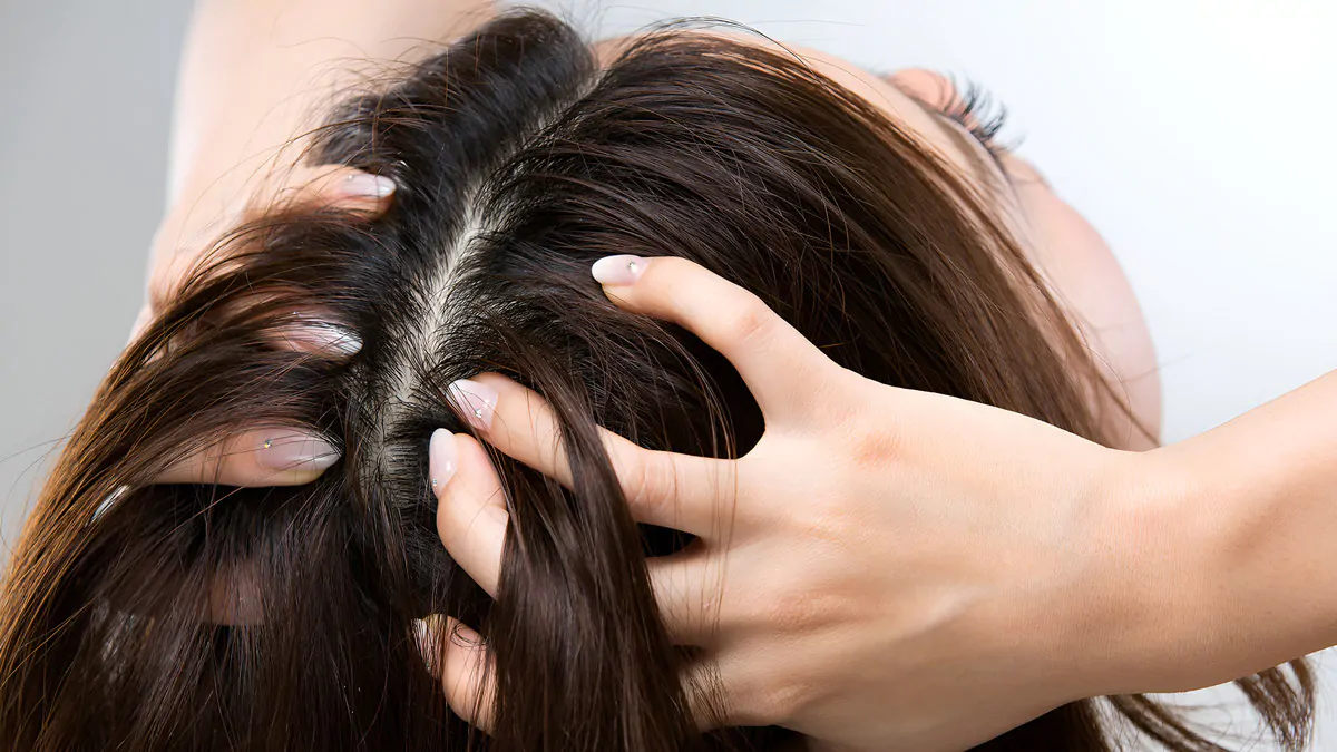 Ritlecitinib, il farmaco contro l’alopecia areata che fa ricrescere i capelli 3