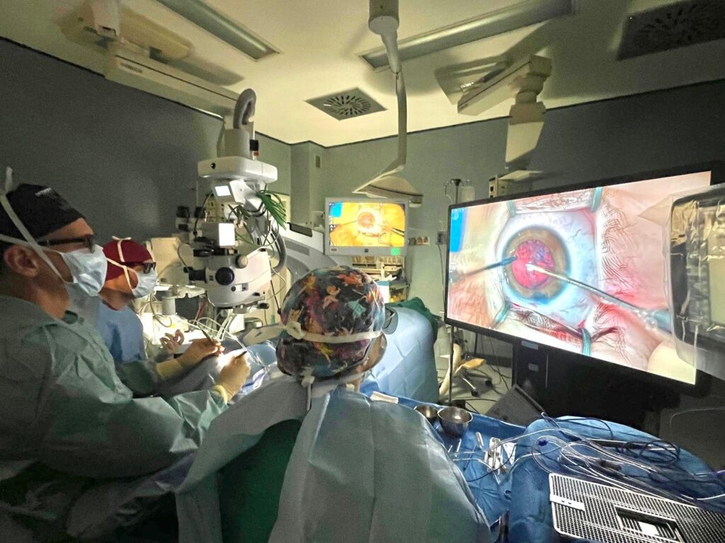 A Torino un intervento dona l'iride a due fratelli affetti da malattia congenita 4 A Torino un intervento dona l'iride a due fratelli affetti da malattia congenita 3