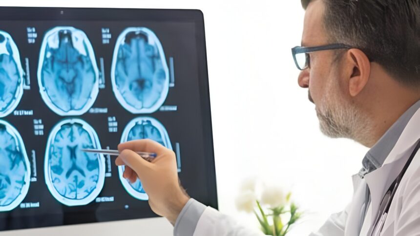 Rivoluzione per la malattia di Huntington: "Una cura ne rallenta i sintomi" 2 Rivoluzione per la malattia di Huntington: "Una cura ne rallenta i sintomi" 1