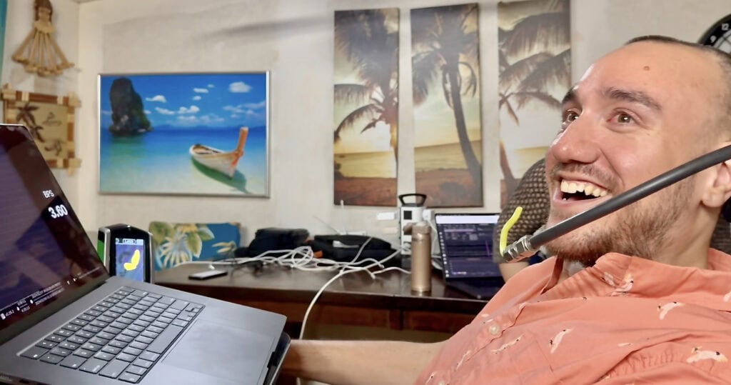 Noland Arbaugh, il primo paziente di Neuralink: "Dopo l'intervento sono risorto" 4 Noland Arbaugh, il primo paziente di Neuralink: "Dopo l'intervento sono risorto" 3