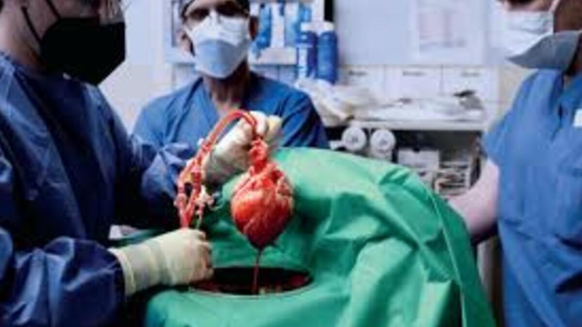 Primo trapianto di polmone da maiale a uomo: “L’organo è rimasto in vita per 9 giorni” 13